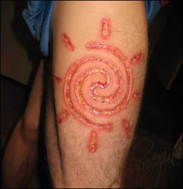 Infected Tattoo