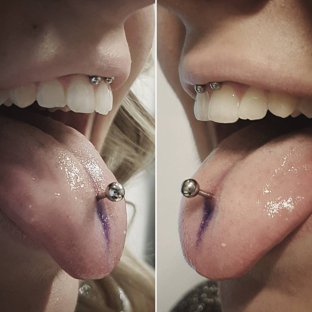 Pros and cons of smiley piercing